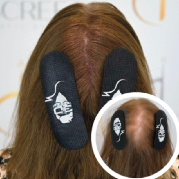 Vitamin D3 treatment image