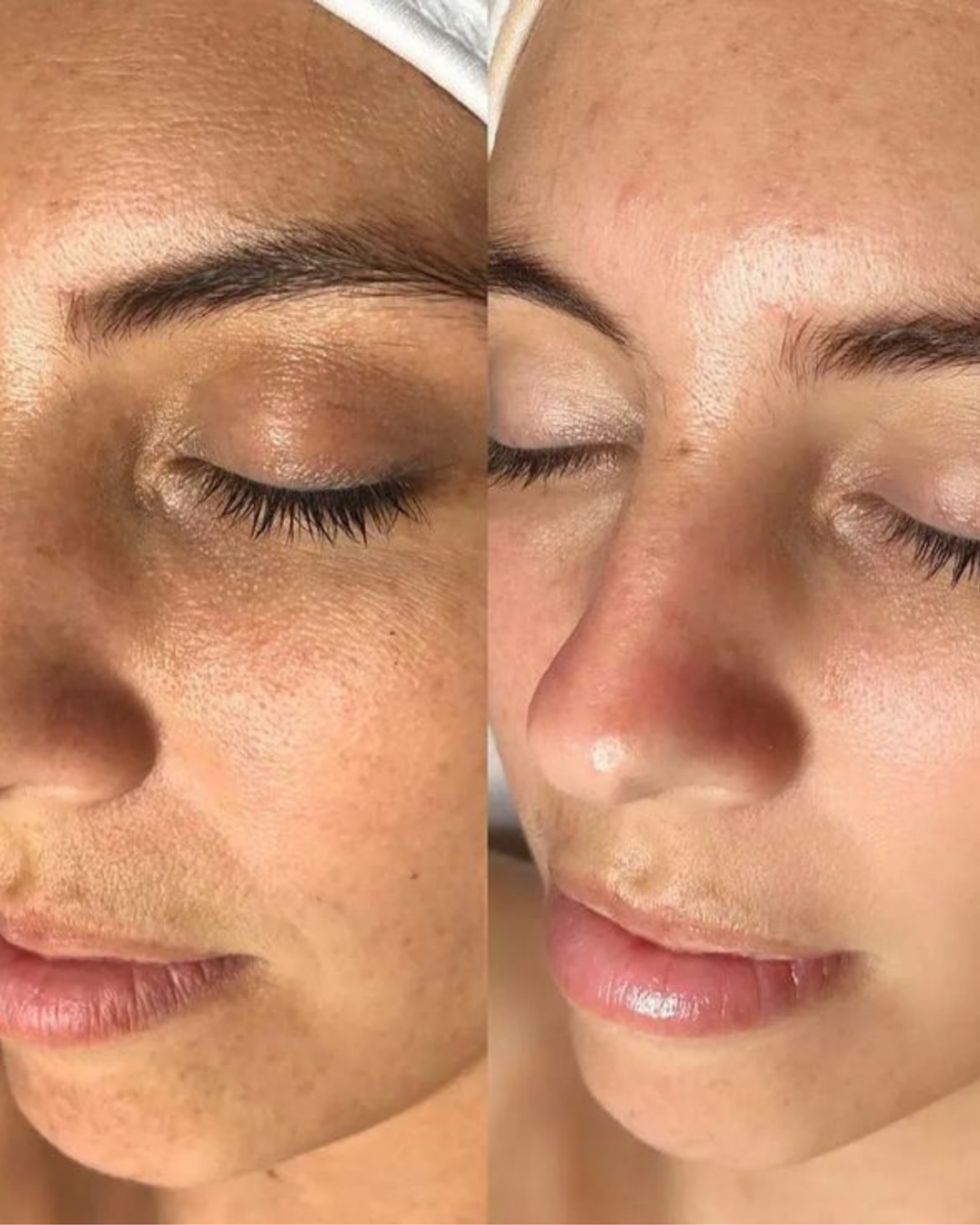 Case 11 before and after