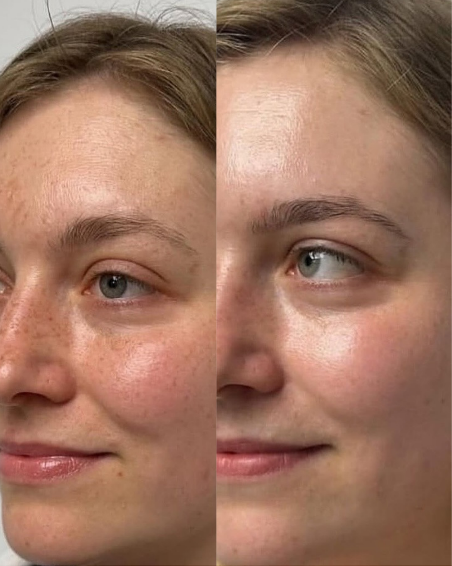 Case 12 before and after