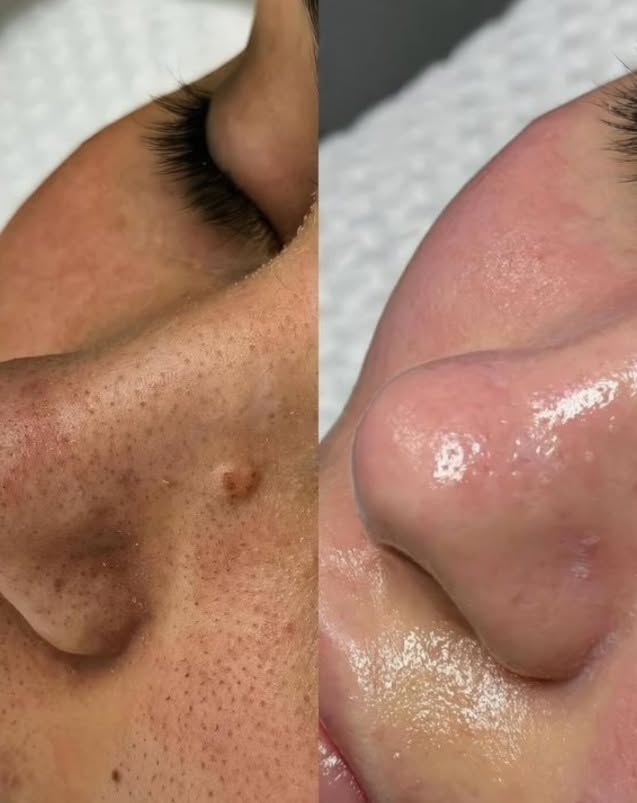 Case 08 before and after