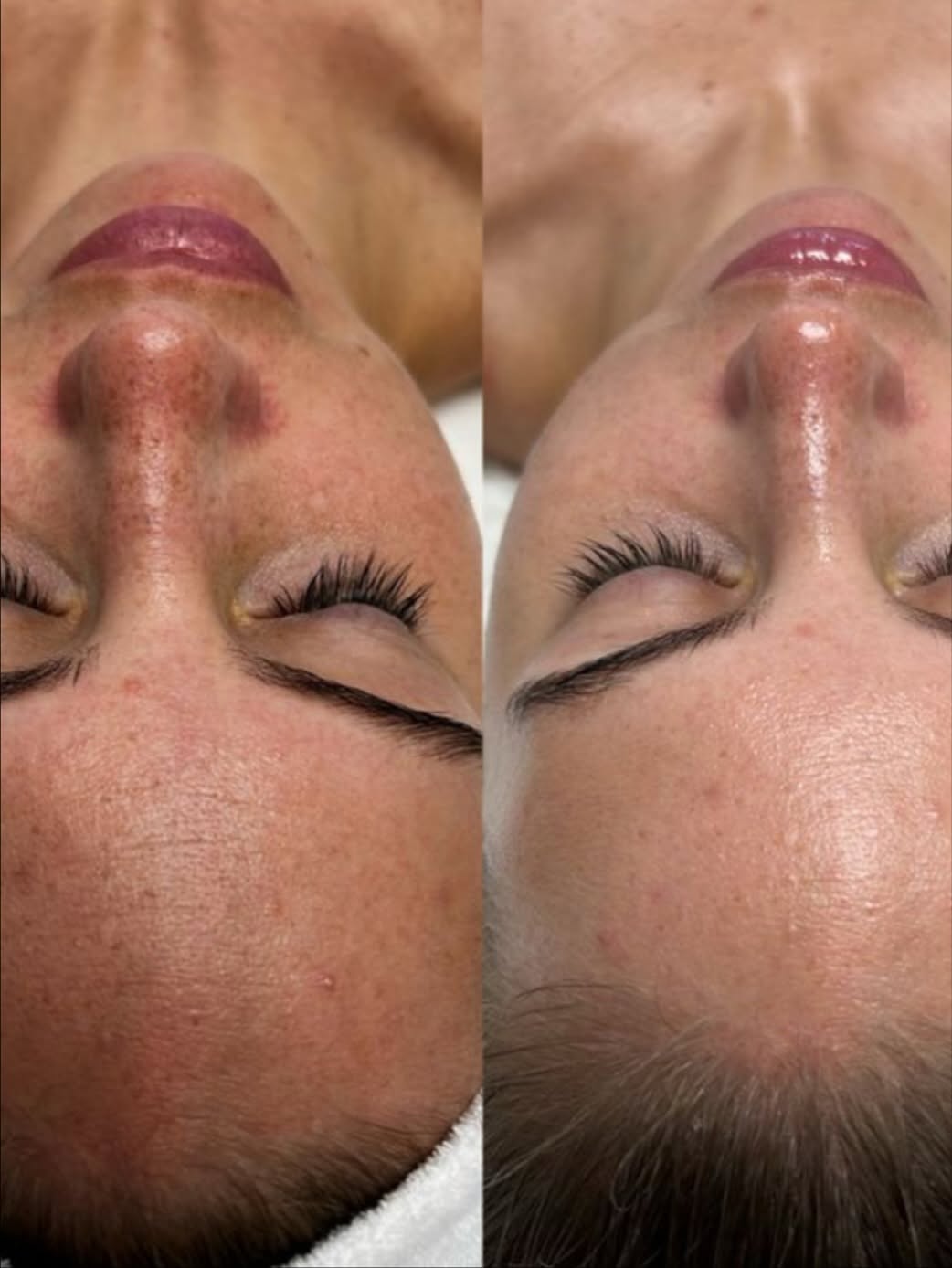 Case 10 before and after