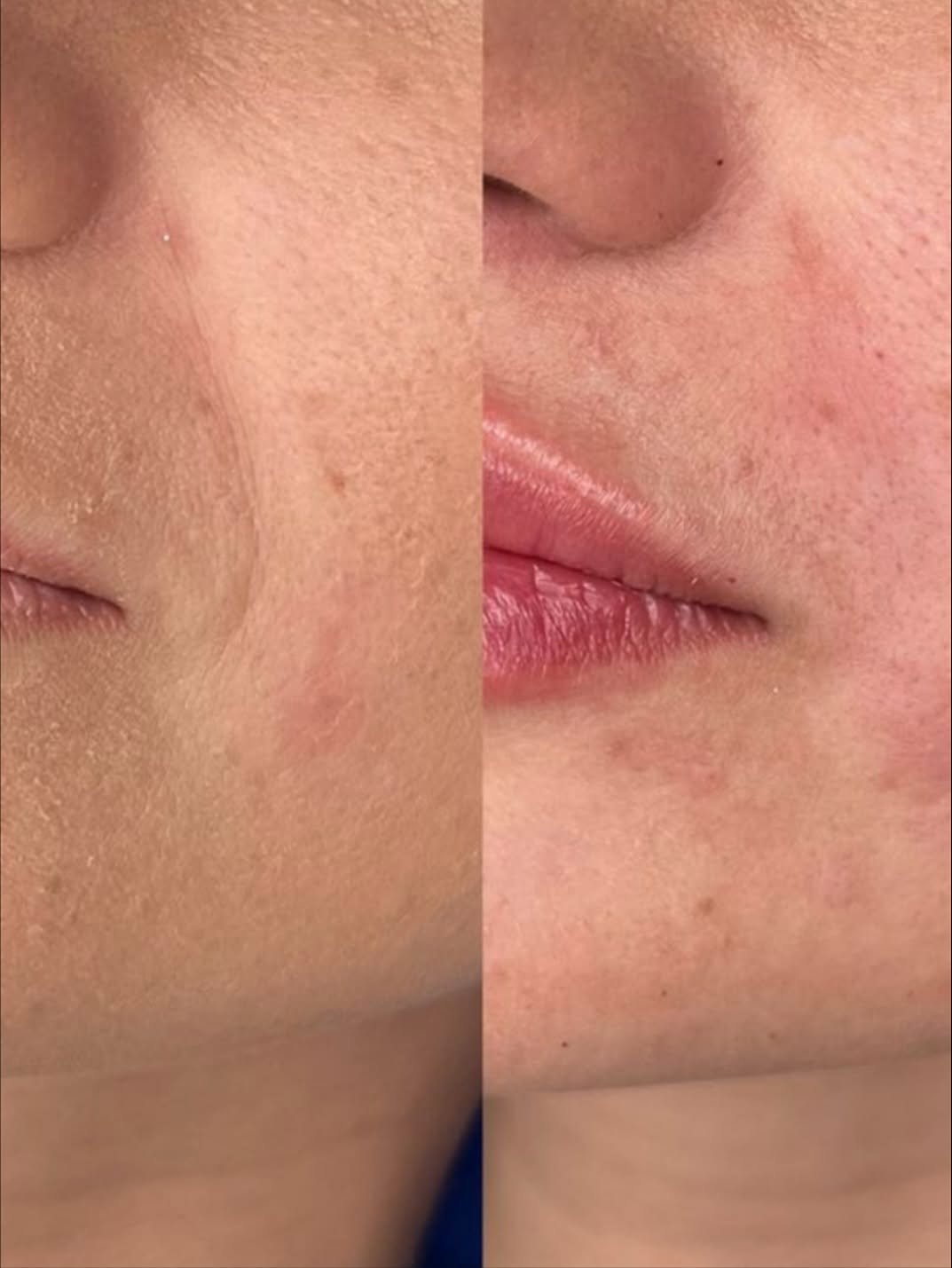 Case 06 before and after