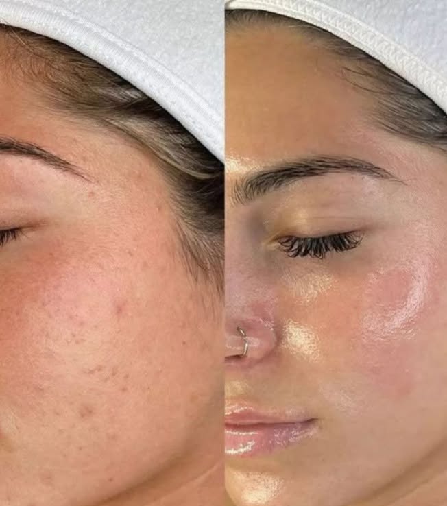 Case 09 before and after
