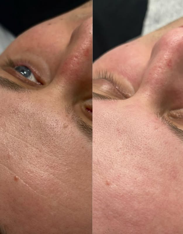 Case 07 before and after