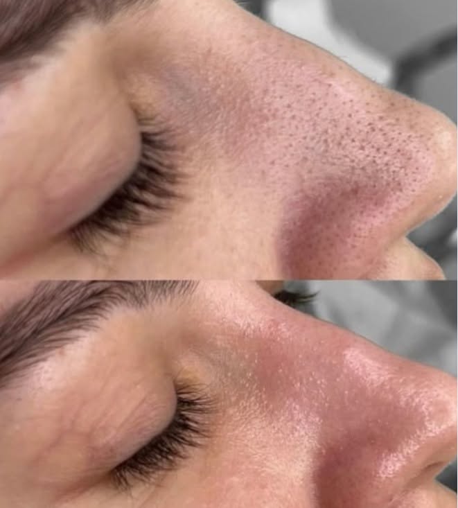 Case 05 before and after