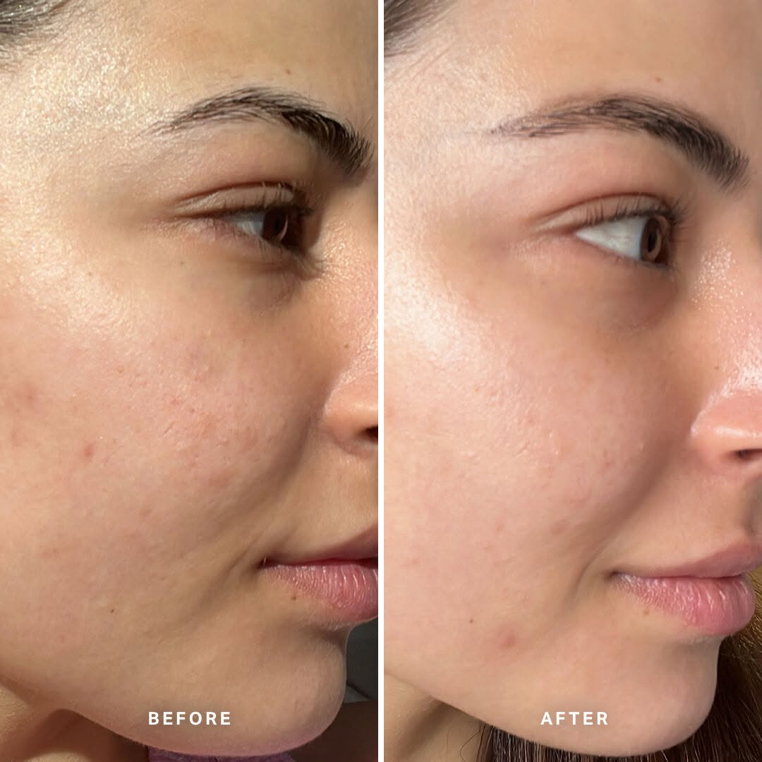 Case 02 before and after
