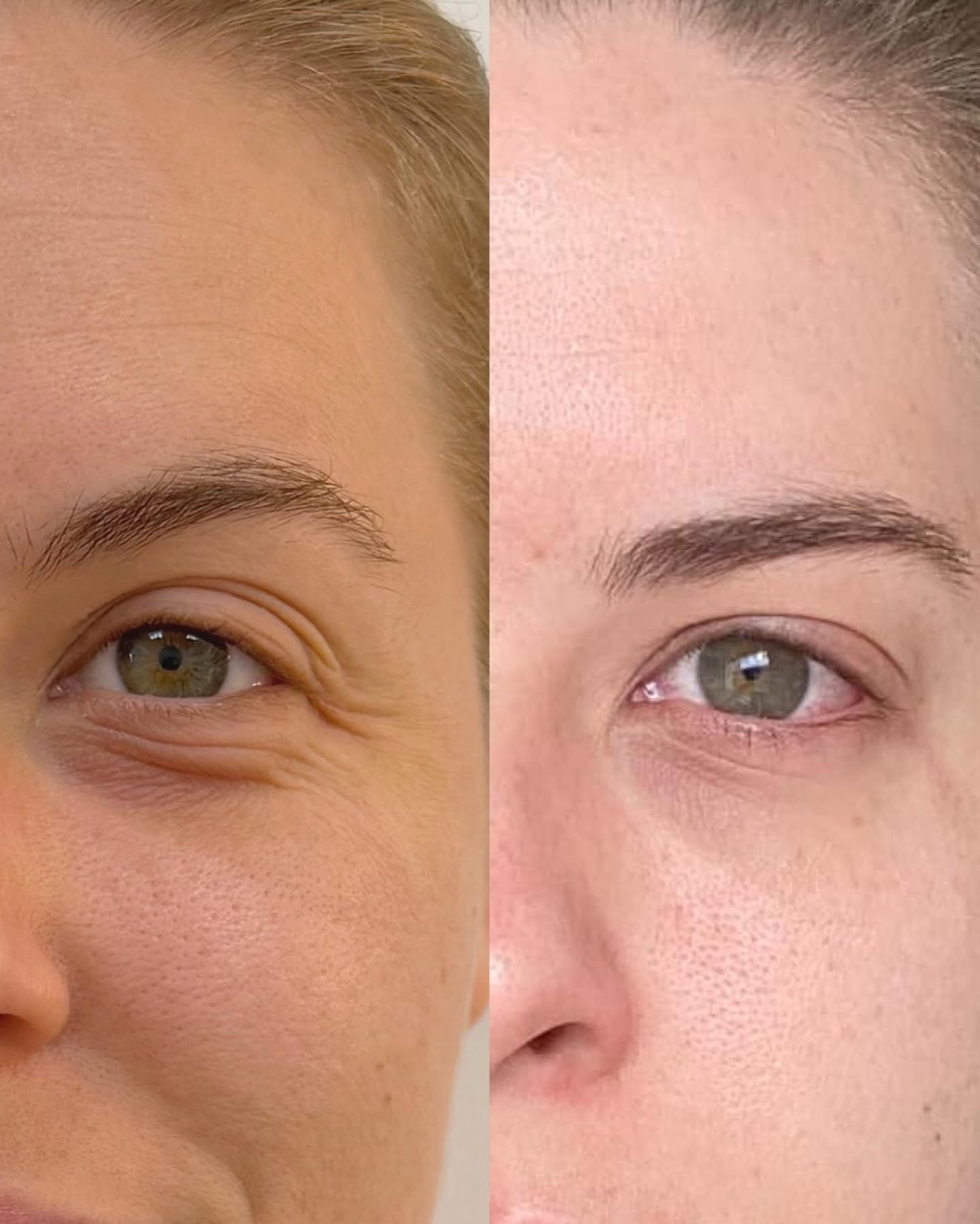 Case 03 before and after