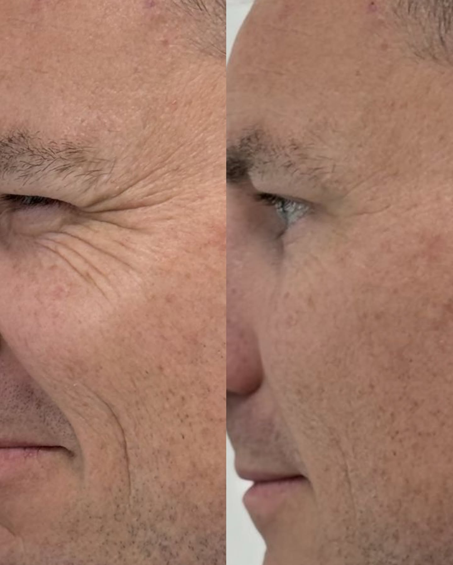 Case 01 before and after