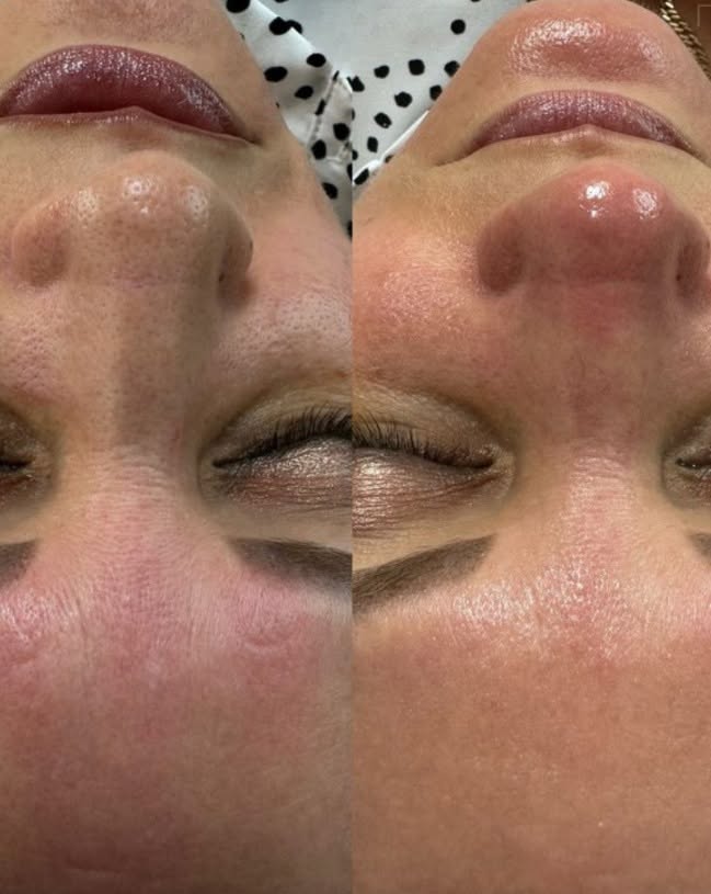 Case 04 before and after