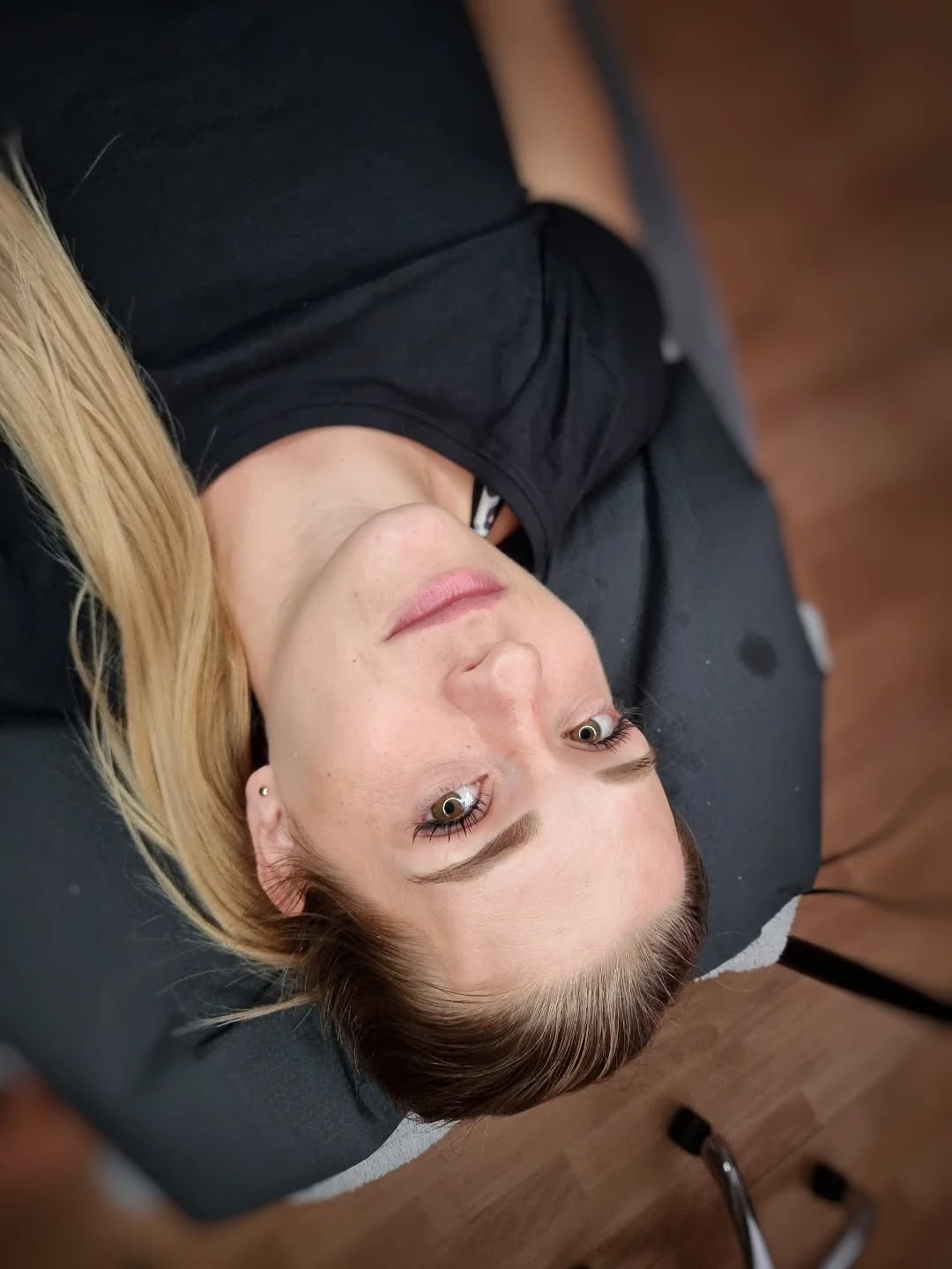 Brow lift