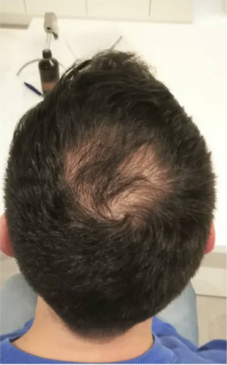 After