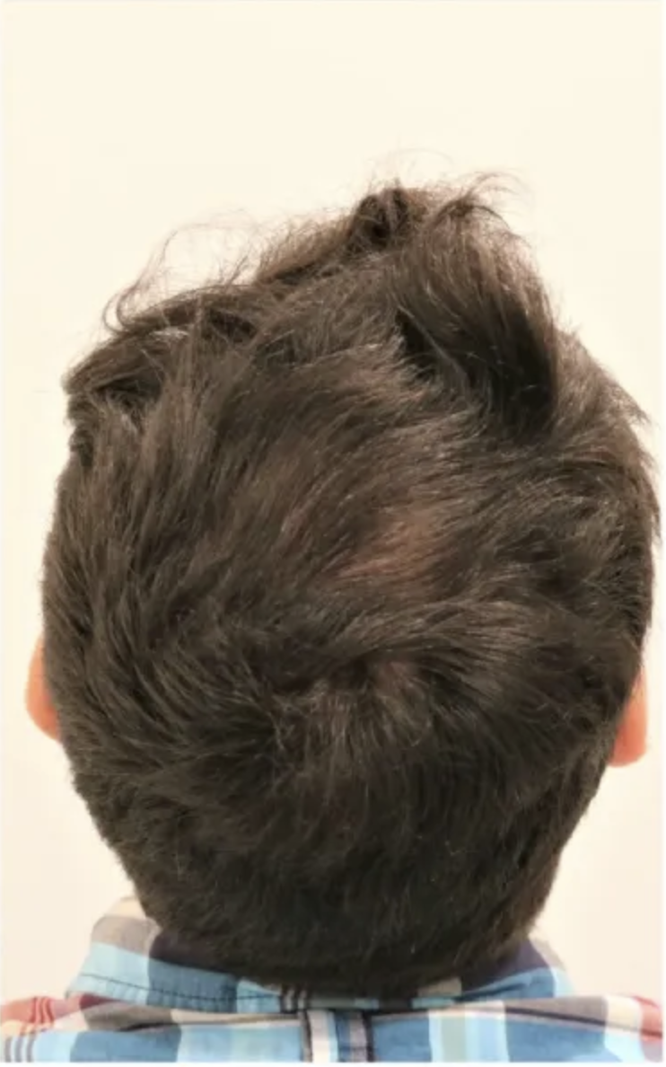 Before