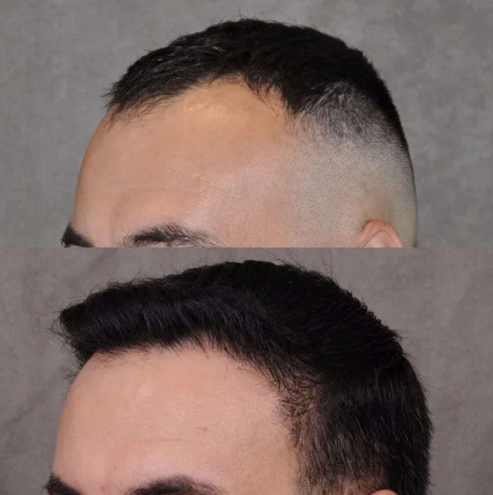 Step 04