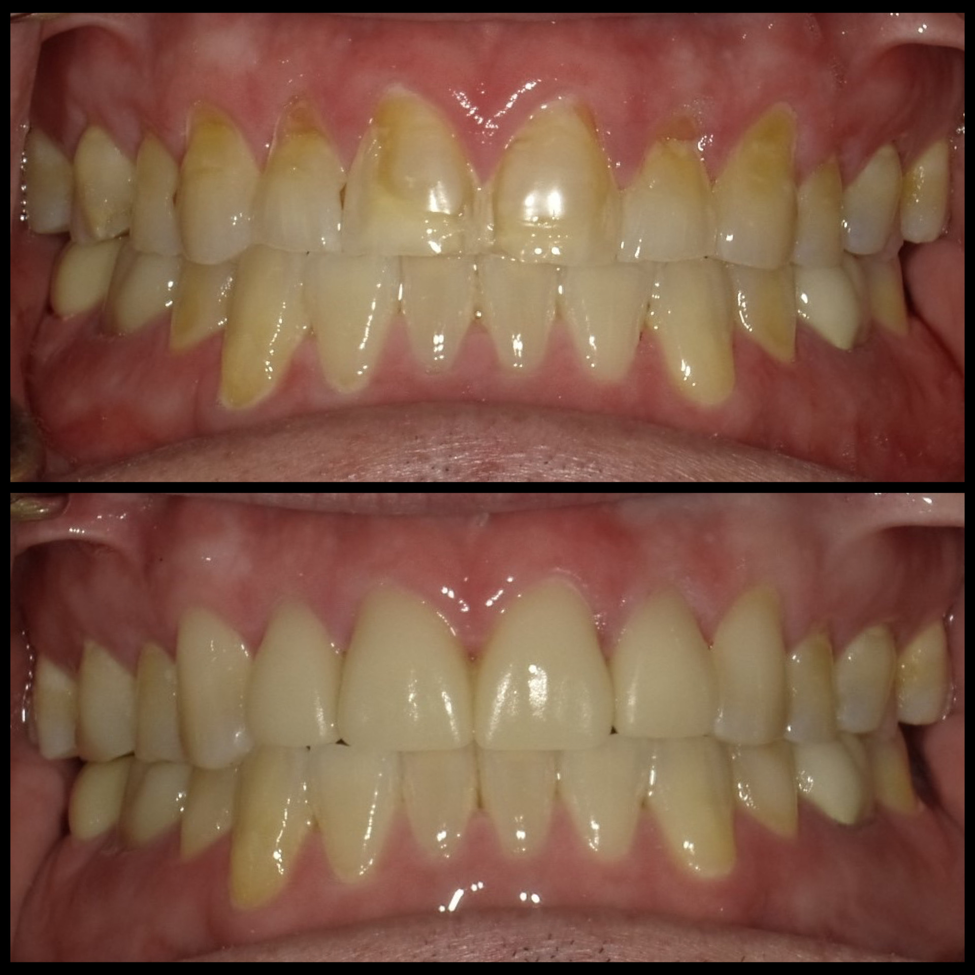 Smile Transformation 14