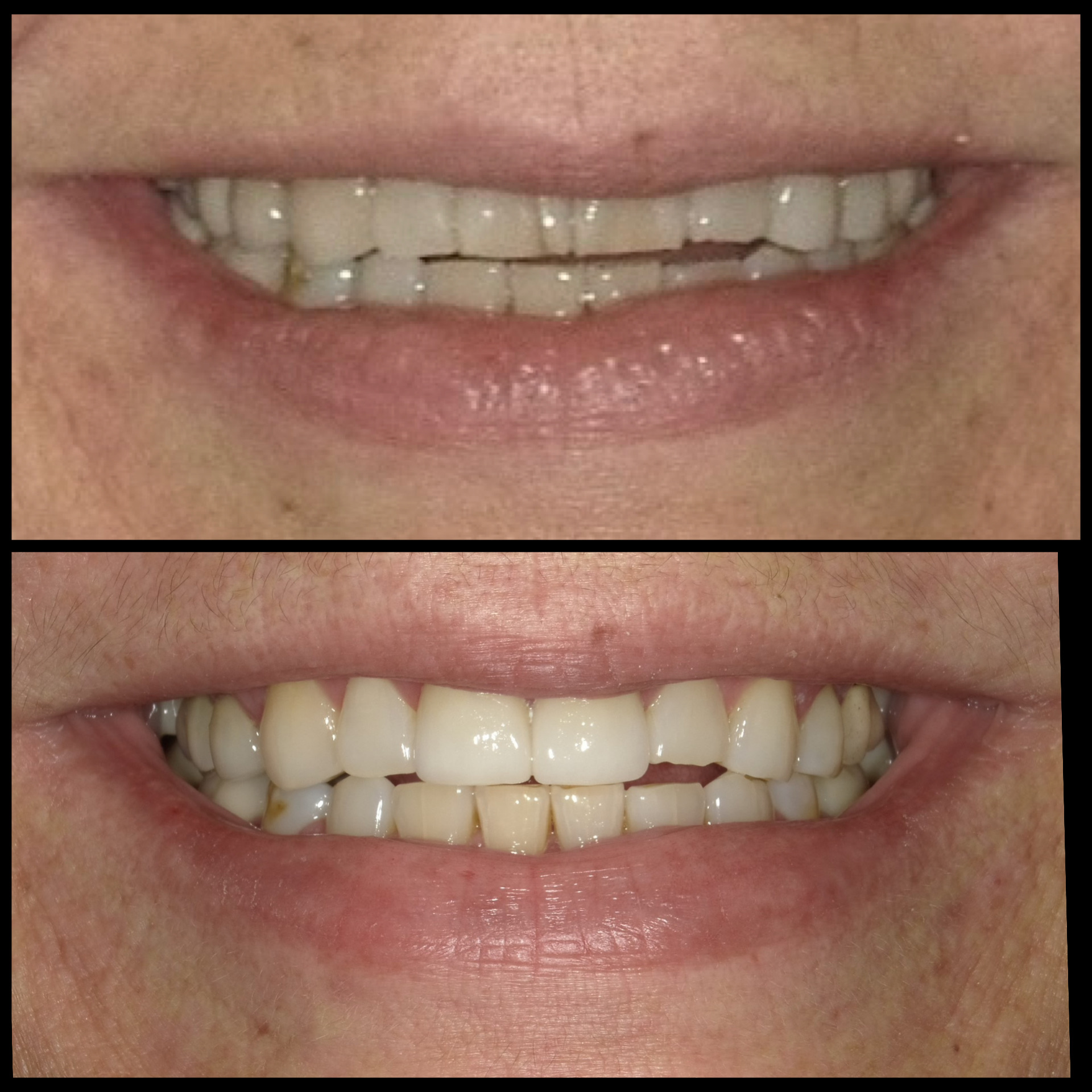 Smile Transformation 19