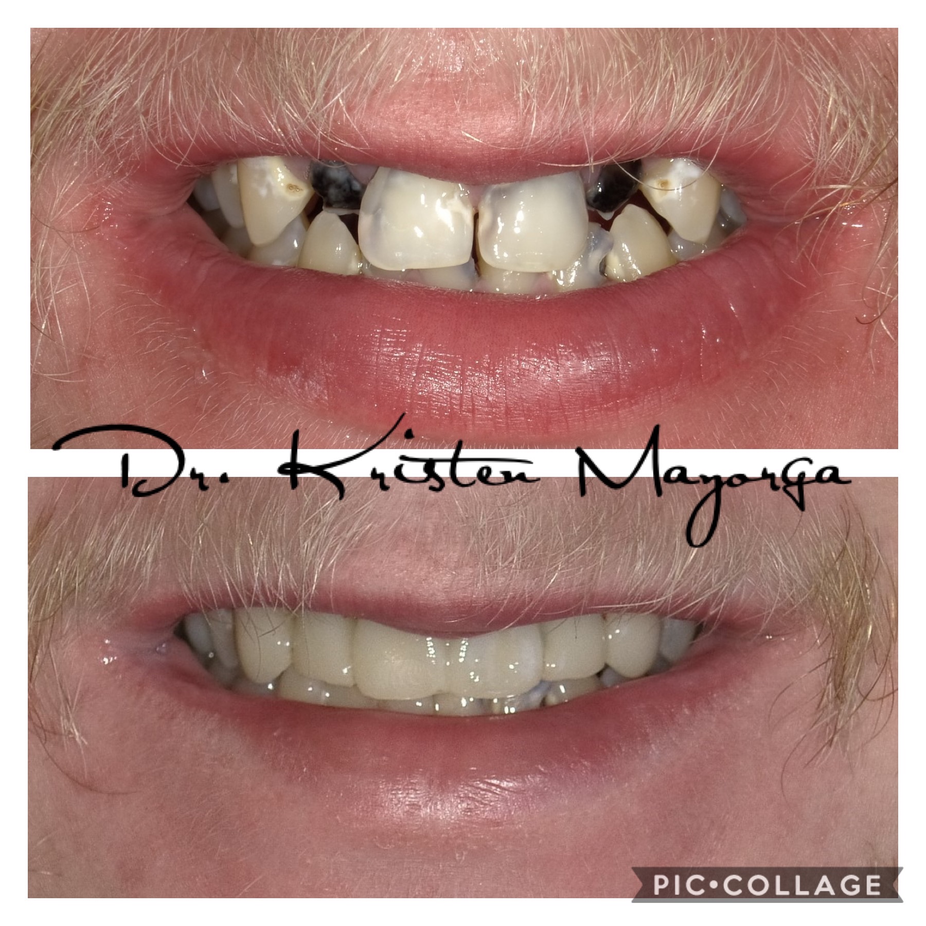 Smile Transformation 18