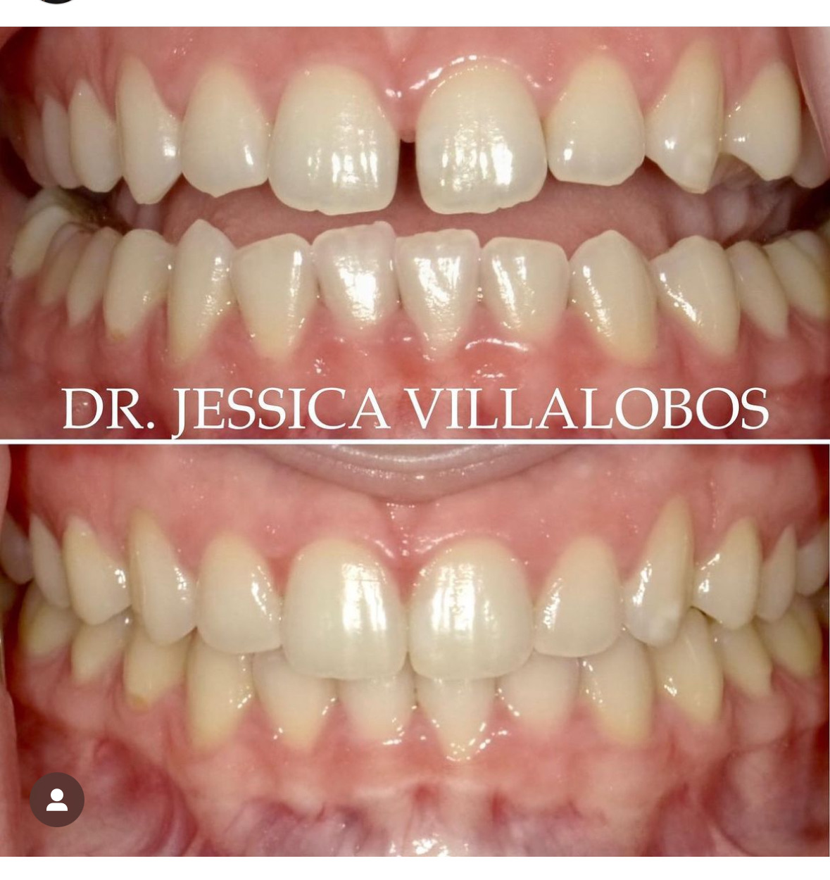 Smile Transformation 13