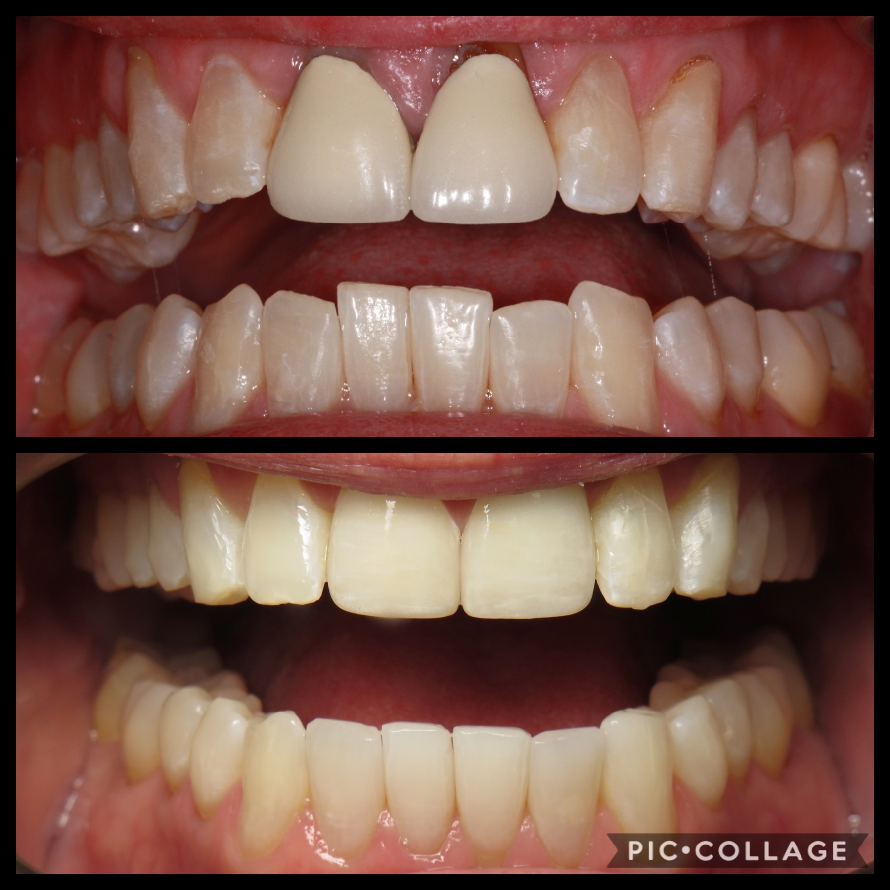 Smile Transformation 10