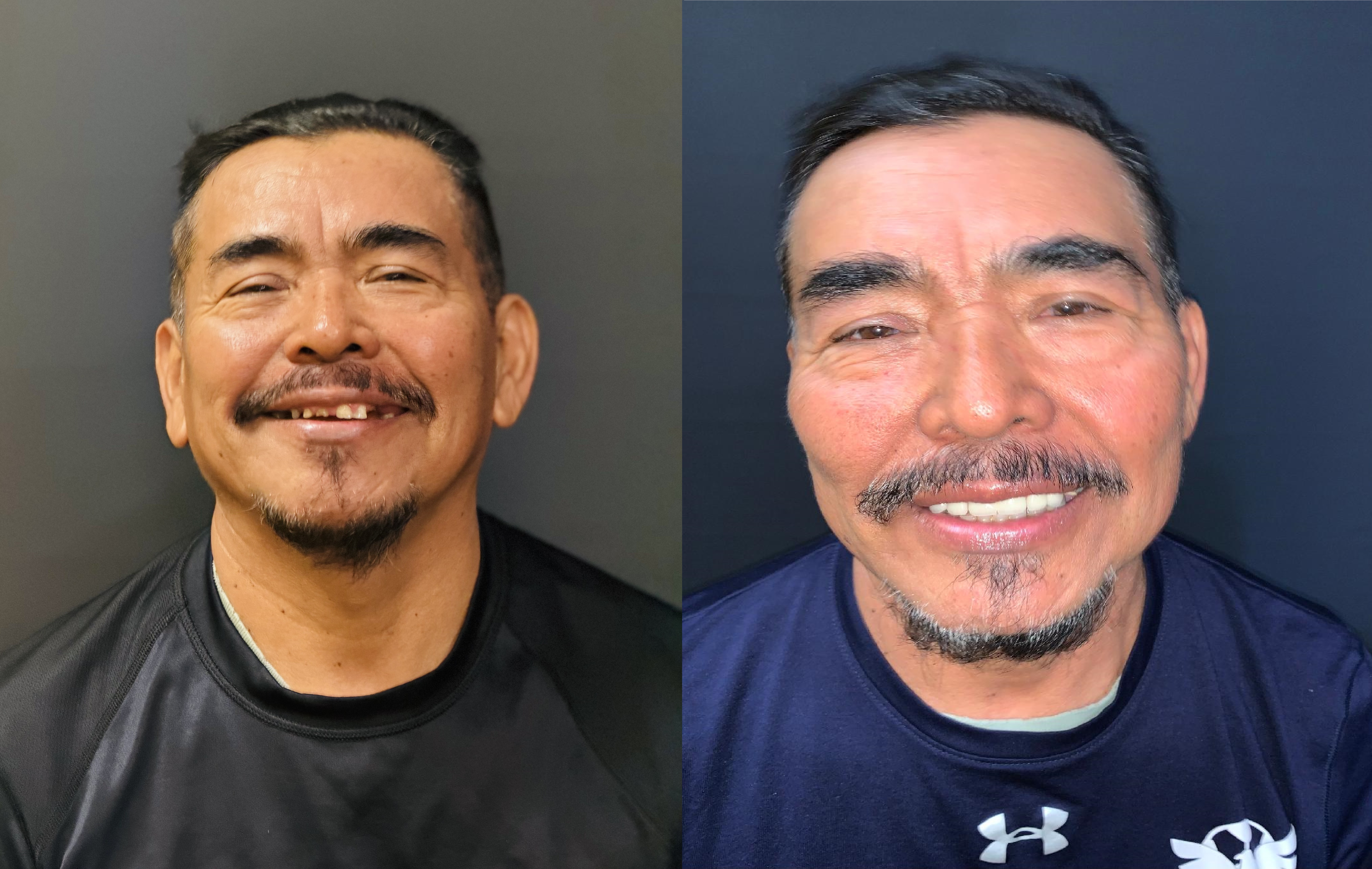 Patient smile result