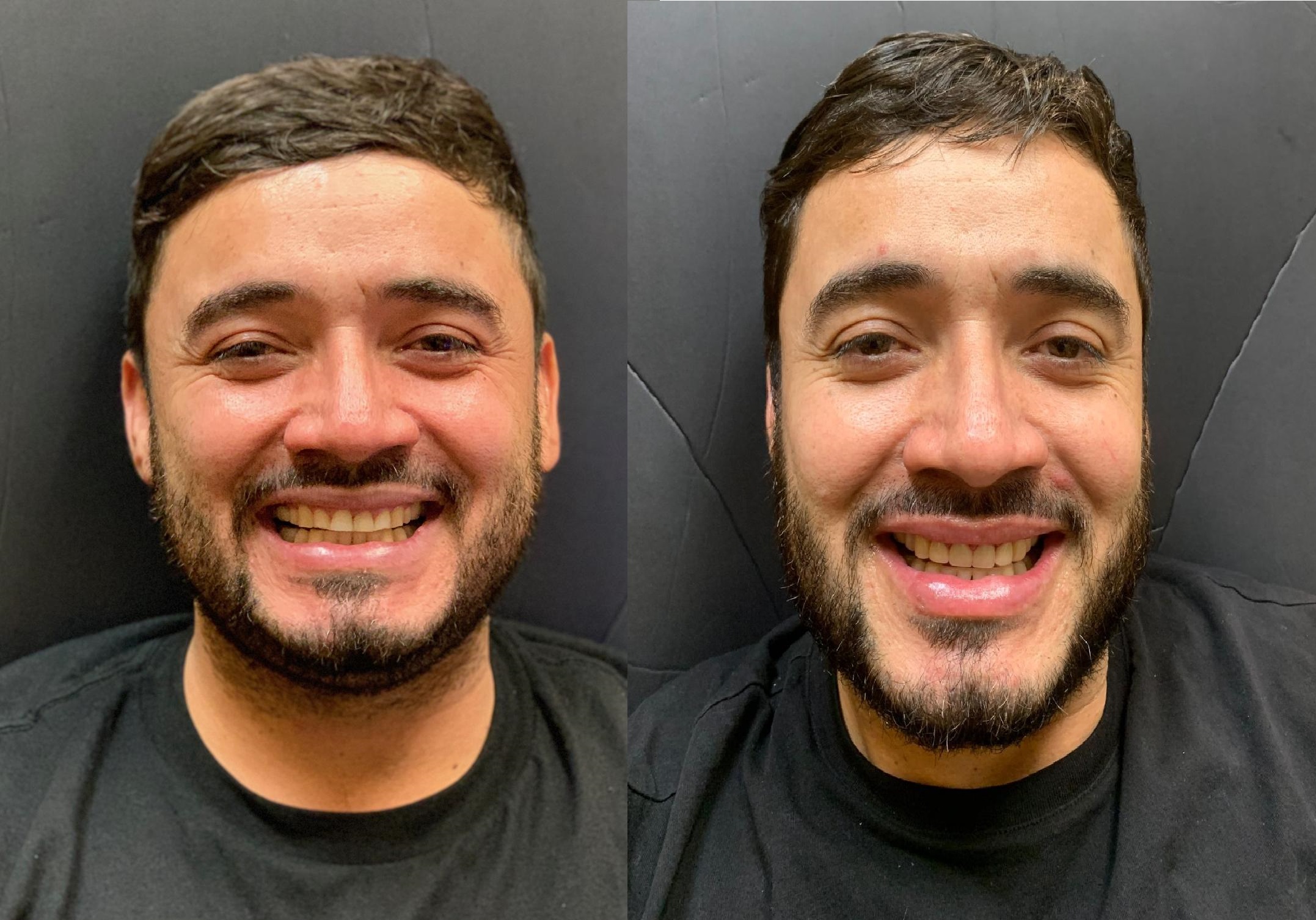 Patient smile result