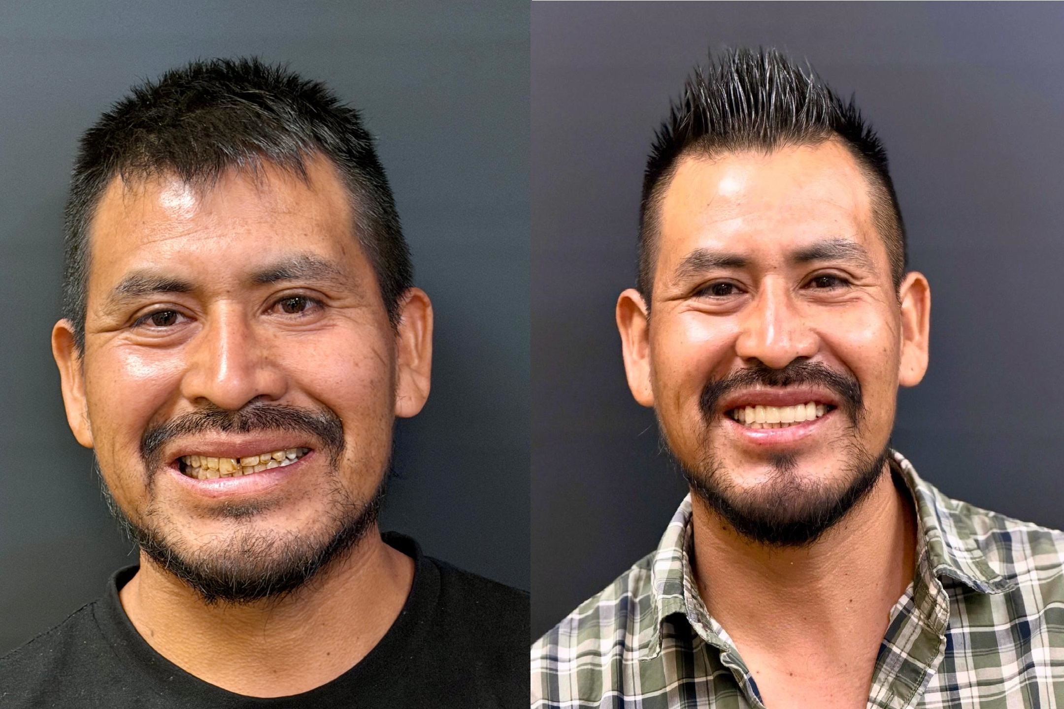 Patient smile result