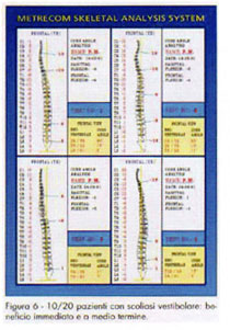 TABELLA 1 - Principali scuole di Terapia Manuale e terminologie correlate alle manipolaizoni