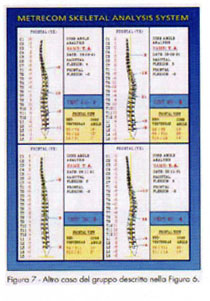 TABELLA 1 - Principali scuole di Terapia Manuale e terminologie correlate alle manipolaizoni