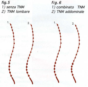 TABELLA 1 - Principali scuole di Terapia Manuale e terminologie correlate alle manipolaizoni