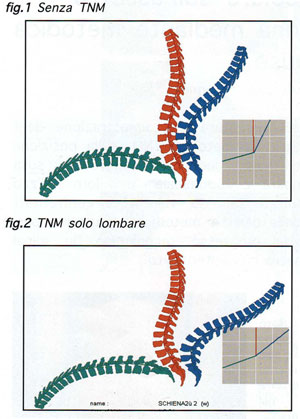 TABELLA 1 - Principali scuole di Terapia Manuale e terminologie correlate alle manipolaizoni