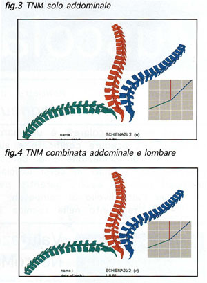 TABELLA 1 - Principali scuole di Terapia Manuale e terminologie correlate alle manipolaizoni