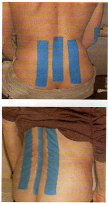 TABELLA 1 - Principali scuole di Terapia Manuale e terminologie correlate alle manipolaizoni