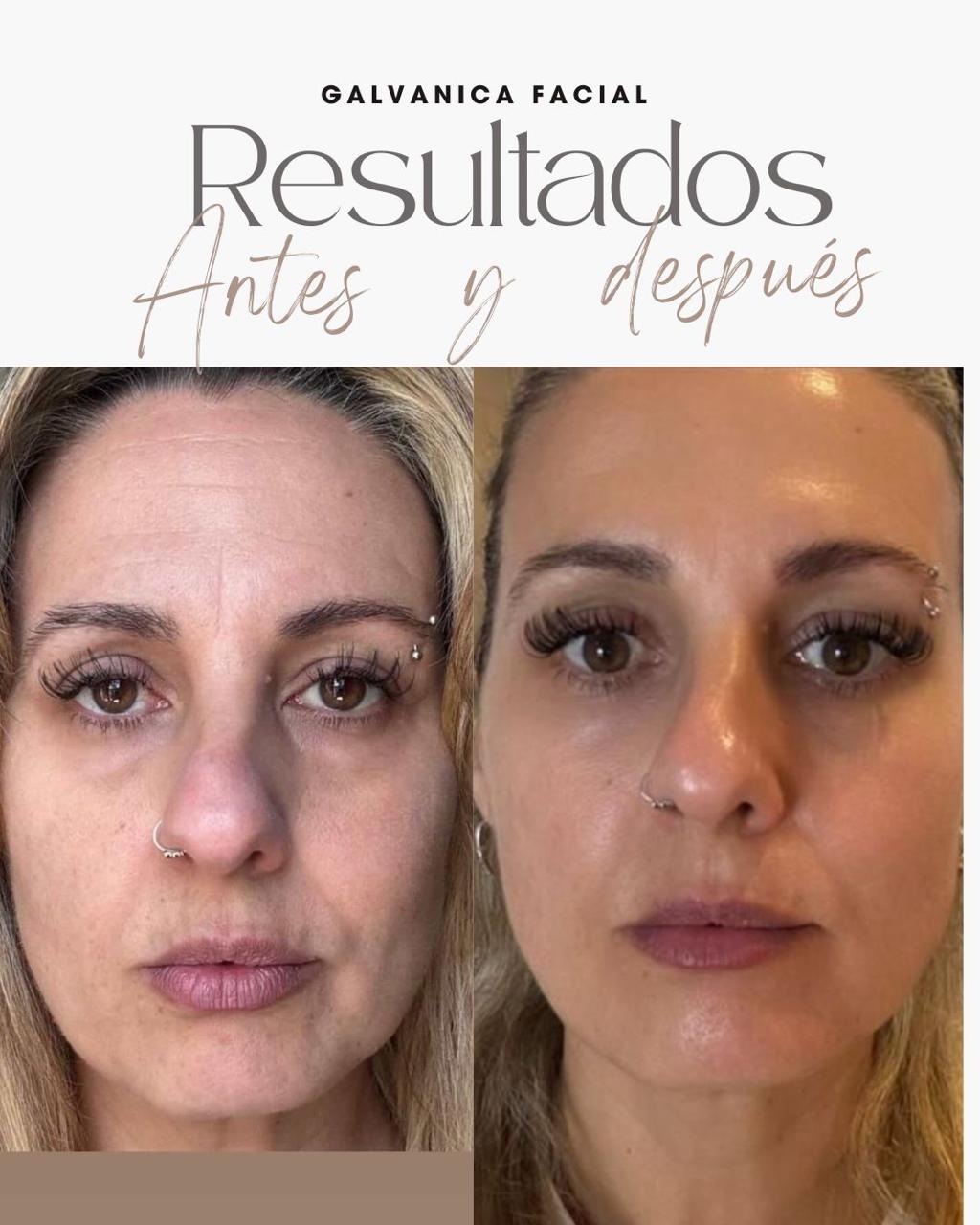 Resultado real del Sistema RESET 2