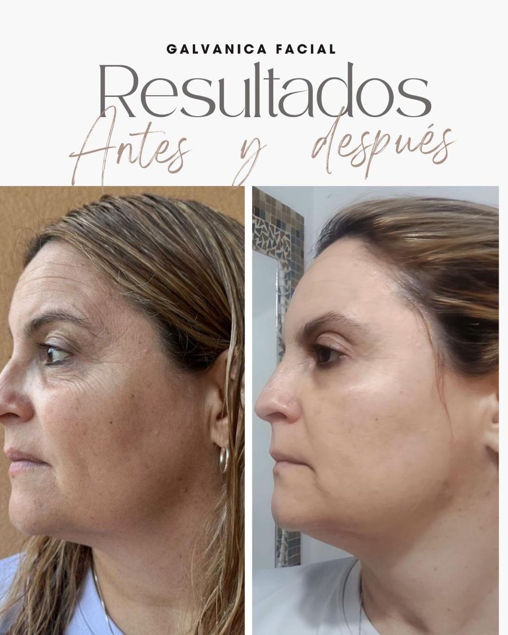 Resultado real del Sistema RESET 3