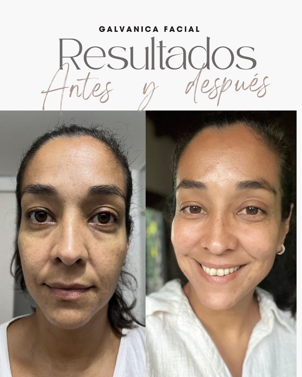 Resultado real del Sistema RESET 1