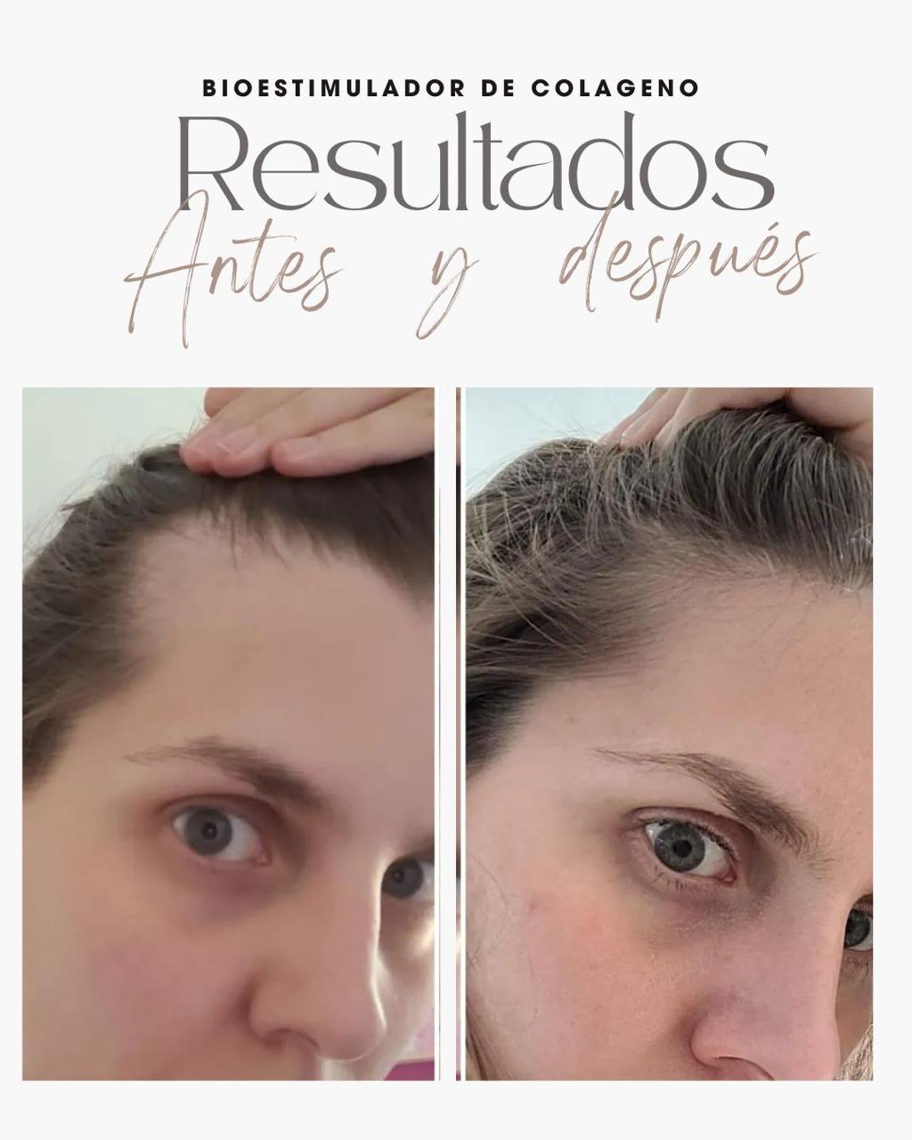 Resultado real del Sistema RESET 8
