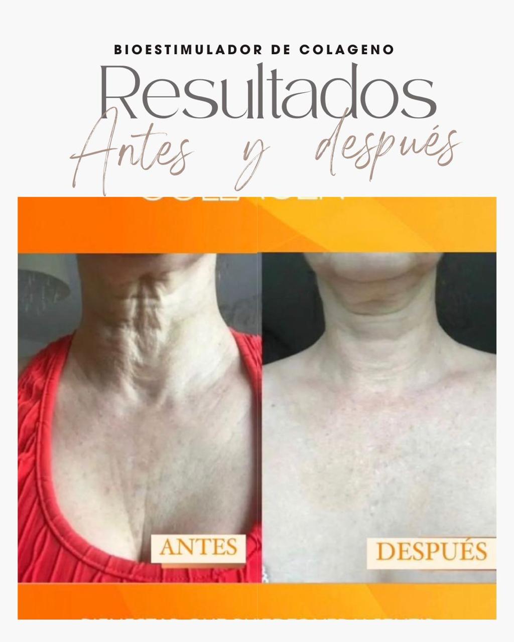 Resultado real del Sistema RESET 7