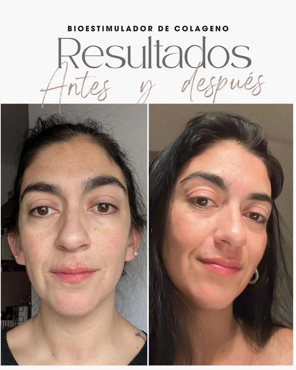 Resultado real con Beauty Focus 1