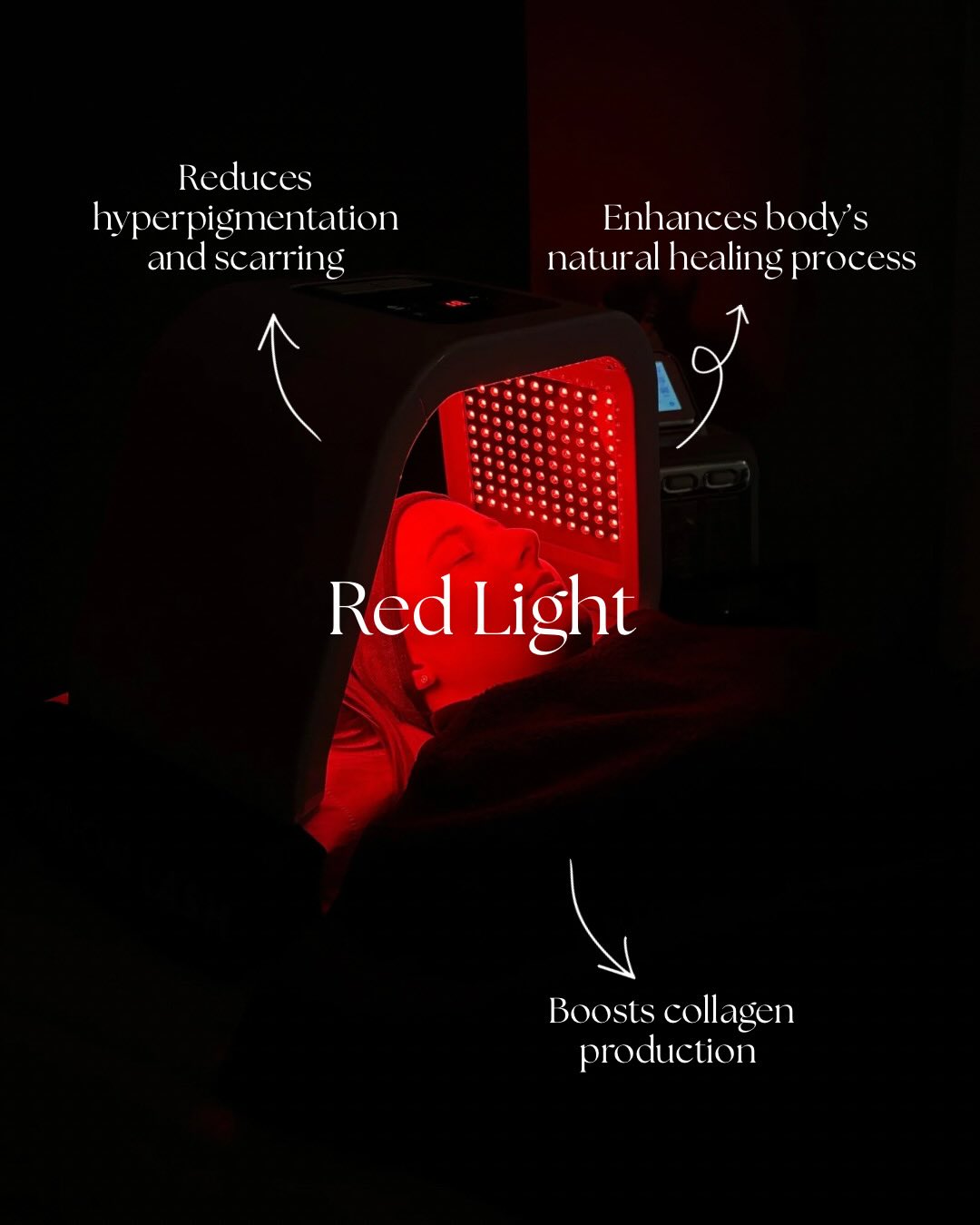 Skincare products selected for the treatment — clean formulation.