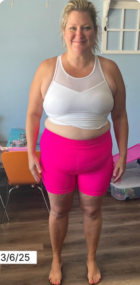 Gina before