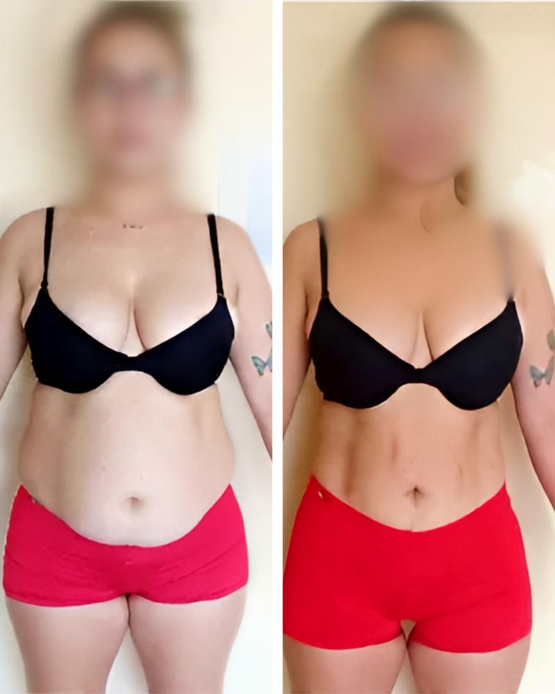 Transformation