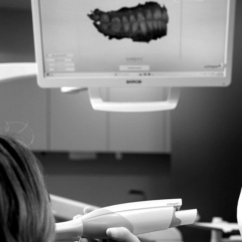 3D sken zuba na ekranu u ordinaciji Le Clinic