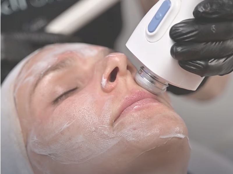 Glacial Skin Treatment