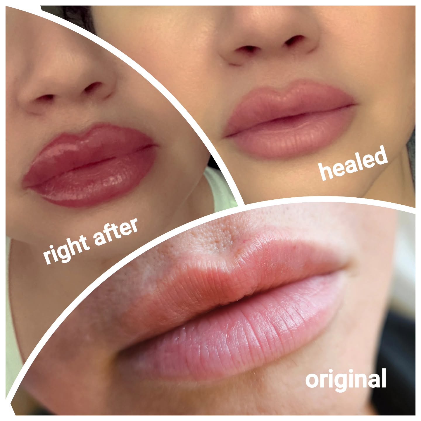 Lip Blushing