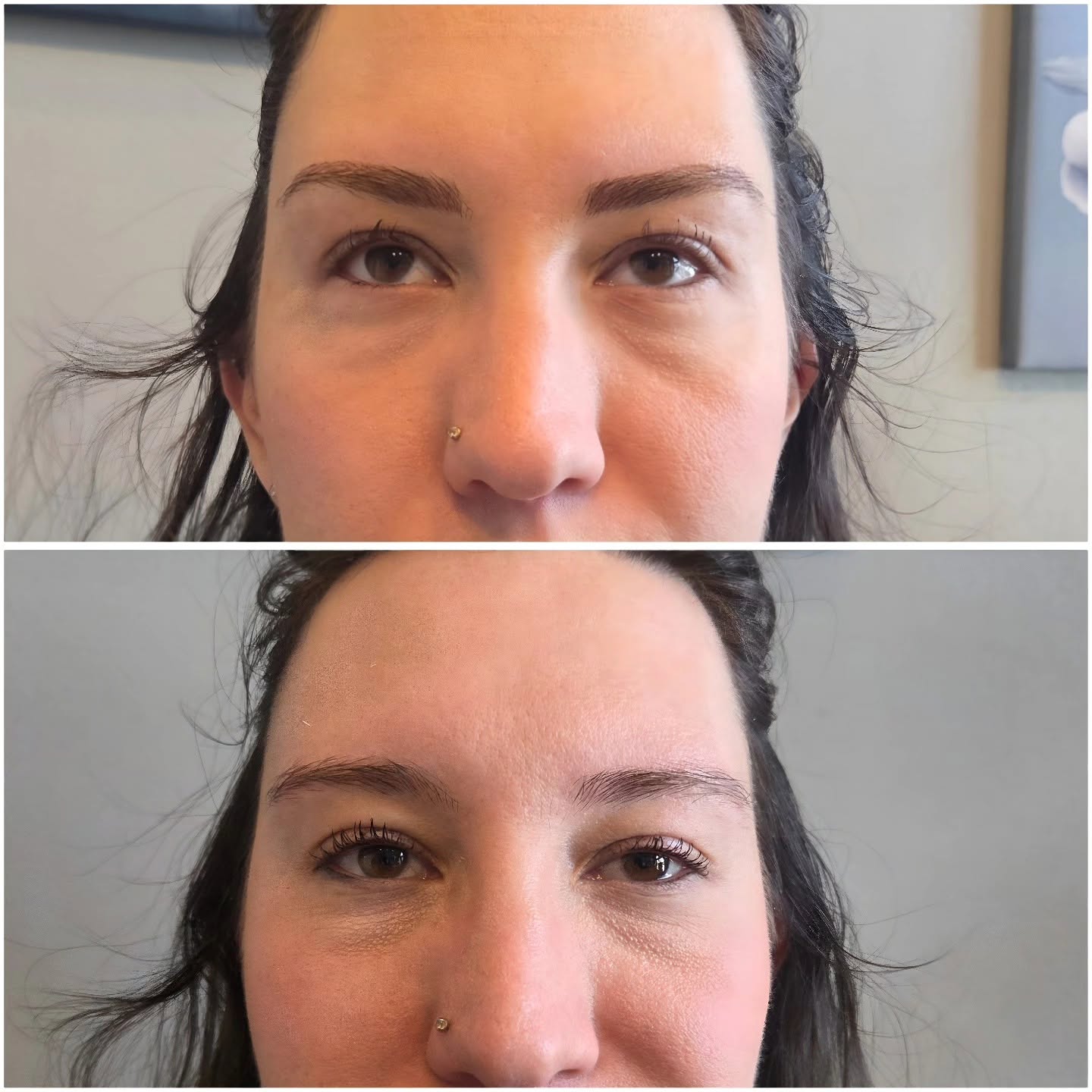 Permanent Eyebrows