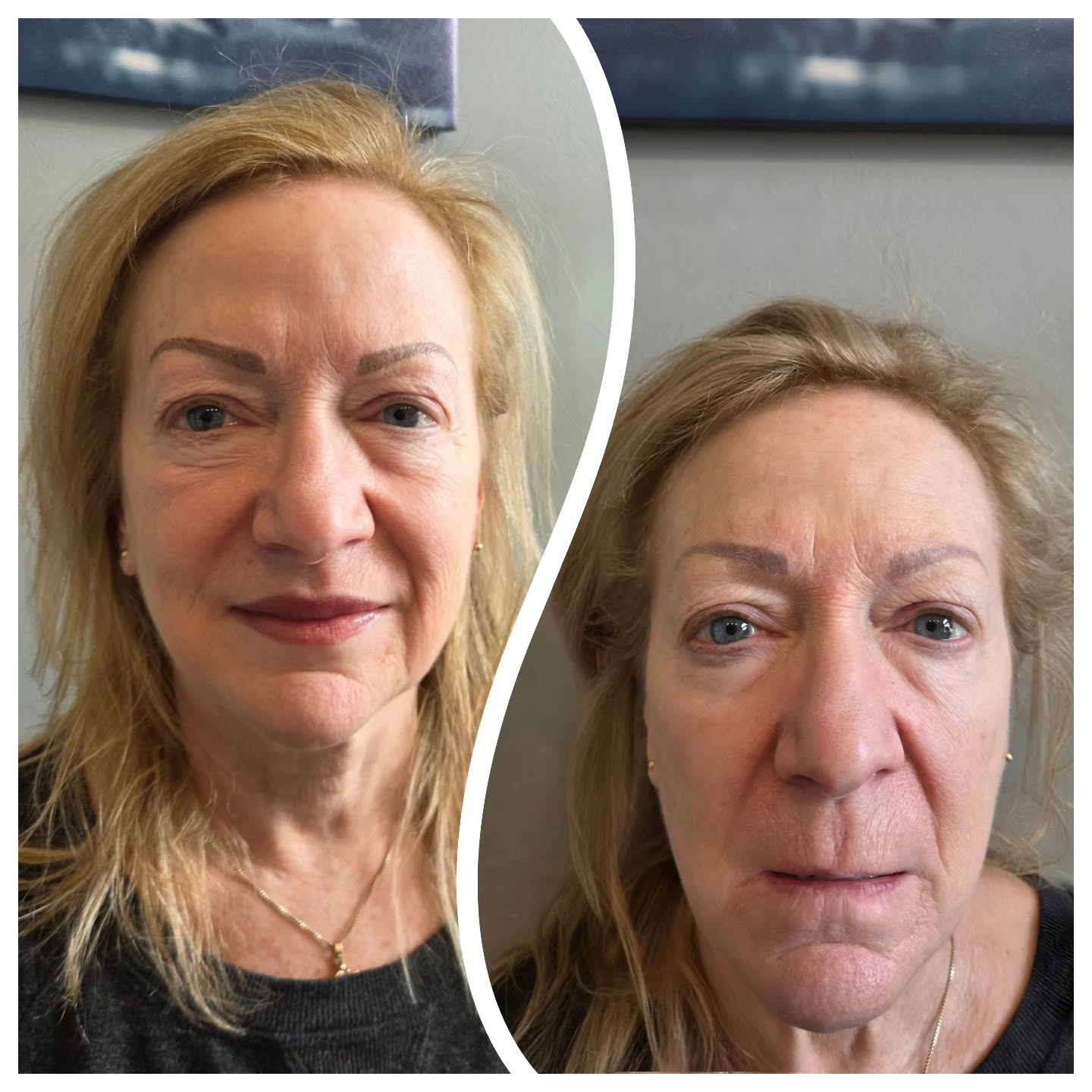 EyEnvy permanent brow result