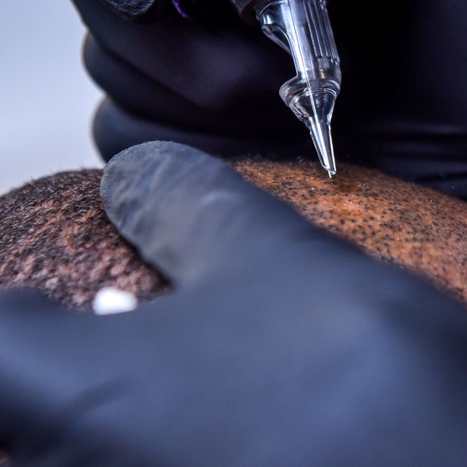 Scalp Micropigmentation Consultation