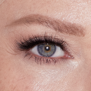 Sparse eyebrow areas that may benefit from Combination Brows
