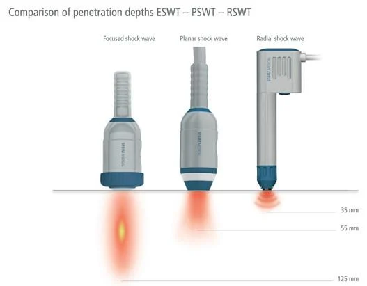 Comparison of penetration depths between focused shockwave, planar shockwave, and radial shockwave devices
