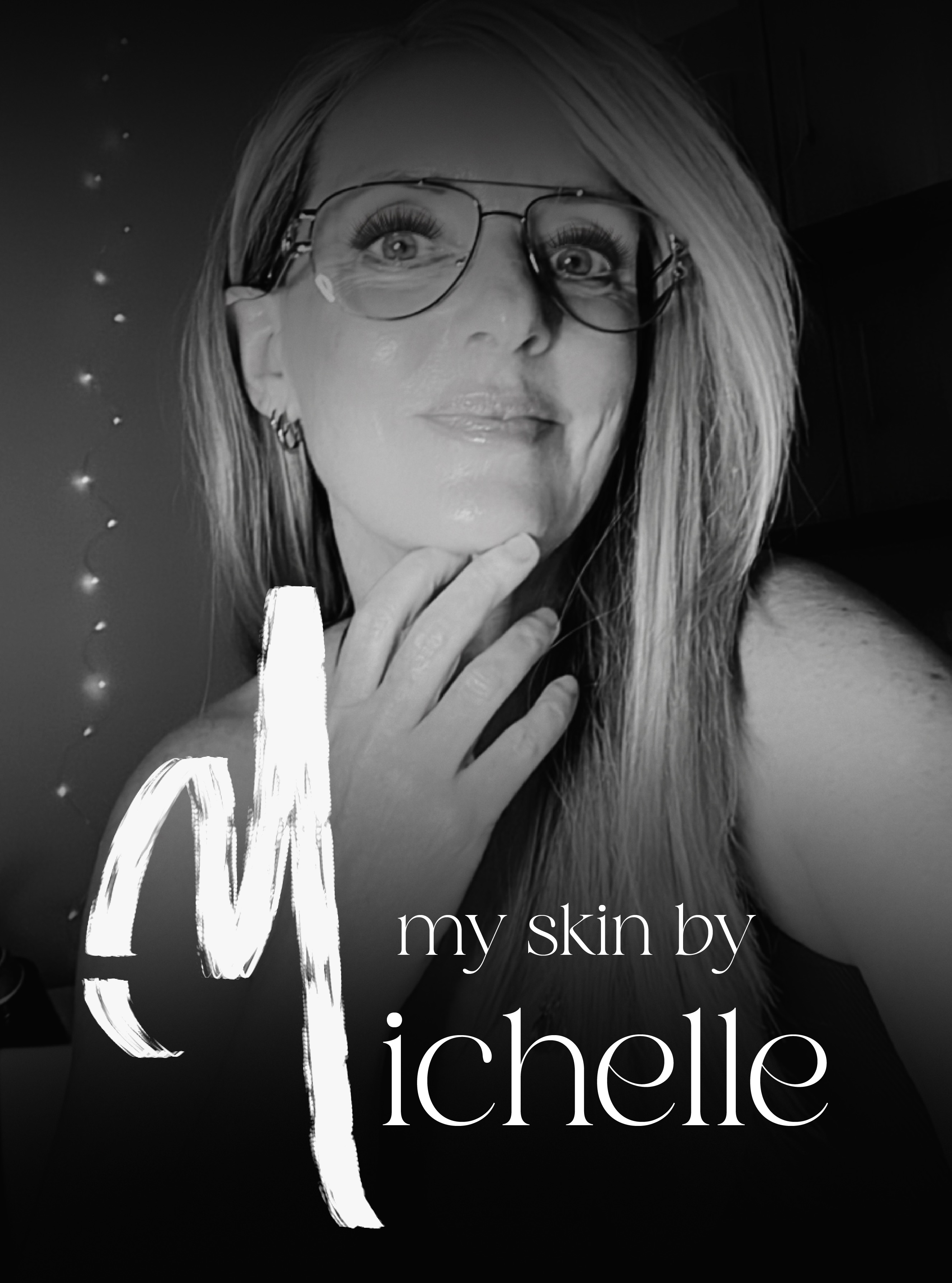 My Skin By Michelle