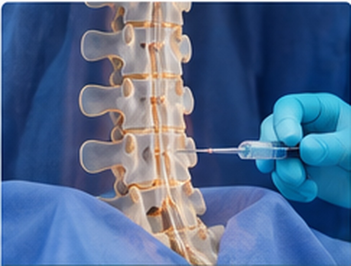 Gloved Hand Administering Injection into Model Spine for Pain Management